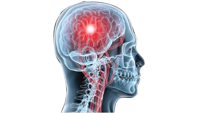 الجهاز العصبي في الفقاريات يشتمل على الدماغ والحبل الشوكي بدون جراحة في