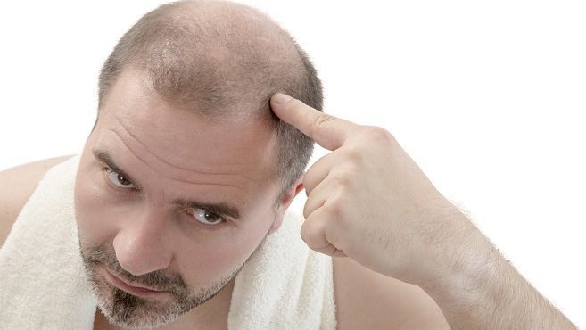 علامات ترافق تساقط الشعر تخفي مشكلات صحية خطيرة - جريدة الغد