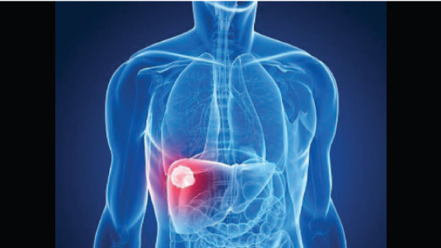 5 علامات على أن الكبد لديك في ورطة – جريدة الغد